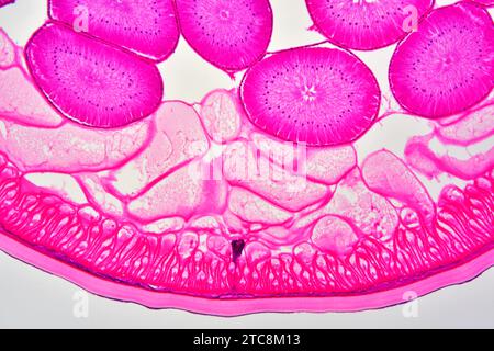 Ascaris lumbricoides weiblich mit Kutikula, Epithel, Ausscheidungskanal, Pseudocoelom und Eierstöcken. Lichtmikroskop X150 mit einer Breite von 10 cm. Stockfoto