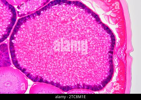 Ascaris lumbricoides weiblich mit Kutikula, Epithel, Längsmuskulatur und Uterus mit Eiern. Lichtmikroskop X150 mit einer Breite von 10 cm. Stockfoto