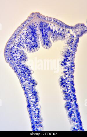 Hydra, Längsschnitt mit Ektoderm, Endoderm und gastrovaskulärer Höhle. Lichtmikroskop X300 mit einer Breite von 10 cm. Stockfoto