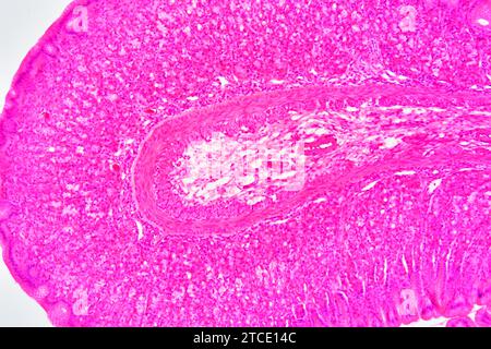 Magenquerschnitt mit Schleimhaut, Submukosa, Muskelschicht und Magendrüsen. Optisches Mikroskop X100. Stockfoto