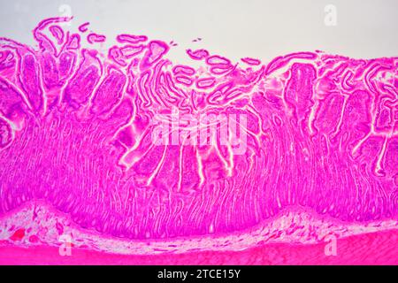 Dünndarmquerschnitt mit Schleimhaut, Submukosa, Lamina propria und Brunner Drüsen. Optisches Mikroskop X40. Stockfoto