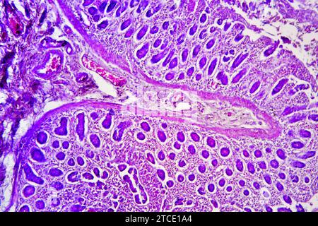 Dünndarmquerschnitt mit Schleimhaut, Submukosa, Lamina propria und Brunner Drüsen. Optisches Mikroskop X40. Stockfoto