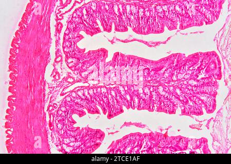 Rektum (Dickdarm) mit Adventitia, Muskelschicht, Lamina propria, Submukosa, Schleimhaut, Epithel, Zotten und Darmdrüsen. Optisches Mikro Stockfoto