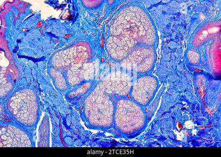 Menschlicher Kopfhautquerschnitt mit Talgdrüsen und Fasergewebe. Optisches Mikroskop X100. Stockfoto