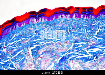 Menschliche Haut mit Epidermis, Dermis, Blutgefäßen und Kollagenfasern. Optisches Mikroskop X40. Stockfoto