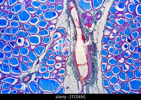 Menschliche Schilddrüse mit Follikeln, Endothelzellen und follikulären Zellen. Optisches Mikroskop X40. Stockfoto