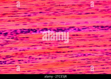 Dichtes Bindegewebe oder dichtes faseriges Gewebe mit Fibroblasten, Kollagenfasern und Matrix. Optisches Mikroskop X400. Stockfoto