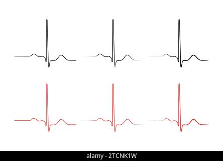 Ventrikuläre Repolarisation, Herzzyklus, EKG des Herzens bei normalem Sinusrhythmus, QT-Intervall des EKGs. Stock Vektor