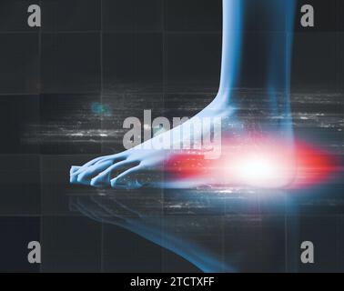 Medizinische Bildgebung und medizinische Behandlungen. Analgetika-Konzept und Muskelschmerzen und Entzündungen an Füssen und Fersen.3D-Darstellung. Stockfoto