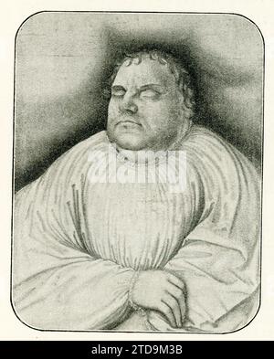 Dieses Bild zeigt das Gemälde von Lucas Cranach dem Ältesten von Martin Luther auf seinem Sterbebett. Martin Luther war ein deutscher Priester, die führende Figur der Reformation, und seine theologischen Überzeugungen bilden die Grundlage des Lutheranismus. Luther wurde 1507 zum Priestertum geweiht und starb 1546. Lucas Cranach der ältere (* 1553) war ein deutscher Renaissance-Maler und Printmacher im Holzschnitt und Gravur. Er war für die meiste Zeit seiner Karriere Hofmaler der Kurfürsten von Sachsen und ist bekannt für seine Porträts der Führer der Reformation. Stockfoto