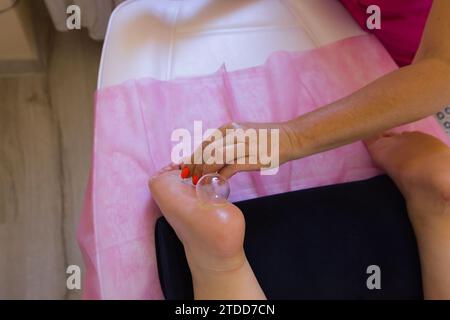 Traditionelle chinesische Schröpftherapie am Rücken von Naturopath. Chinesischer Pokal. Naturheilkunde, Massagen, alternative Medizin, Naturheilkunde. Stockfoto