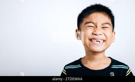 Junge ohne oberen Zahn lächelt breit und zeigt die Lücke. Kind isoliertes Porträt auf weiß. Zahnärztliche Versorgung Stockfoto