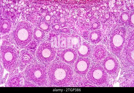 Katzenovari mit Folikel und Corpus luteum. Photomikrograph. Stockfoto