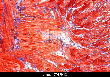 Skelettmuskel mit Quer- und Längsschnitten auf der Zunge. Photomikrograph. Stockfoto