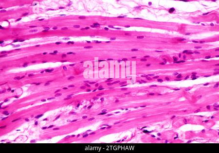 Skelettmuskel, Längsschnitt. Photomikrograph. Stockfoto