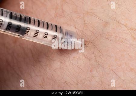 Diabetesmanagement: Injektion von Insulin in den Bauch mit Insulin Pen Stockfoto