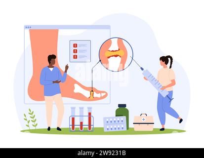 Gichtdiagnostik und -Behandlung, Rheumatologie-Vektorillustration. Karikaturiker erforschen menschliche Fußknochen mit Harnsäurekristallen auf einem infographischen Anatomiediagramm, Ärzte diagnostizieren Hyperurikämie Stock Vektor