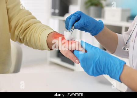 Arzt, der die verbrannte Hand des Patienten im Krankenhaus behandelt, Nahaufnahme Stockfoto