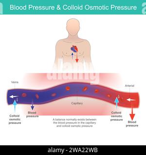 Blutdruck Und Osmotischer Druck. Die Beziehung zwischen Blutdruck und kolloidosmotischem Druck in menschlichen Gefässen. Stock Vektor