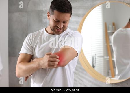 Mann mit Allergie, der sich drinnen den Arm kratzt Stockfoto