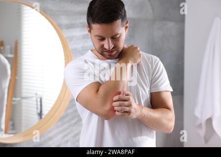 Mann mit Allergie, der sich drinnen den Arm kratzt Stockfoto