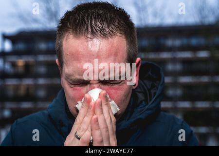 Bayern, Deutschland - 6. Januar 2024: Ein kranker Mann mit Erkältung bläst sich mit einem Papiertaschentuch die Nase *** ein kranker erkälteter Mann putzt sich mit einem Papiertaschentuch die Nase Stockfoto