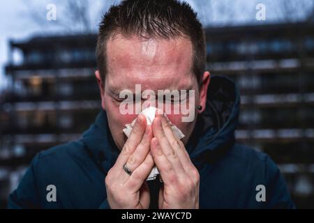 Bayern, Deutschland - 6. Januar 2024: Ein kranker Mann mit Erkältung bläst sich mit einem Papiertaschentuch die Nase *** ein kranker erkälteter Mann putzt sich mit einem Papiertaschentuch die Nase Stockfoto