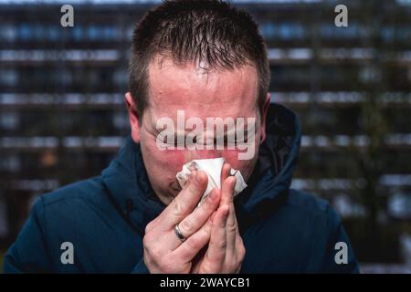 Bayern, Deutschland - 6. Januar 2024: Ein kranker Mann mit Erkältung bläst sich mit einem Papiertaschentuch die Nase *** ein kranker erkälteter Mann putzt sich mit einem Papiertaschentuch die Nase Stockfoto