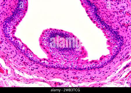 Humanes Übergangsepithel und glattes Muskelgewebe. X125 bei 10 cm Breite. Stockfoto