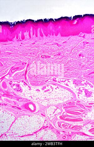 Geschichtete Plattenepithel aus der menschlichen Handhaut, die keratinisierte Epidermis und Dermis mit Bindegewebe zeigt. X25 bei 10 cm Breite. Stockfoto