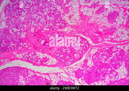 Humane Nabelschnur-Schleimhäute mit Schleimdrüsen, lockeres konjektives Gewebe, Adipozyten, glatten Muskelfasern und Blutgefäßen. X25 bei 10 cm Breite. Stockfoto