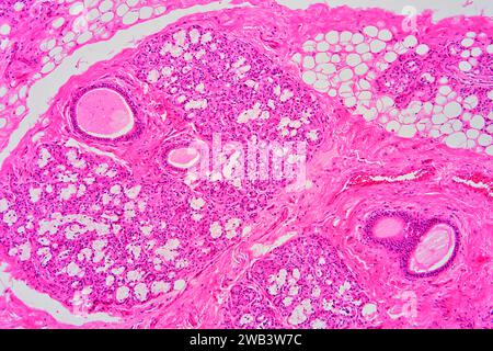 Humane Nabelschnur-Schleimhäute mit Schleimdrüsen, lockeres konjektives Gewebe, Adipozyten, glatten Muskelfasern und Blutgefäßen. X 75 bei 10 cm Breite. Stockfoto