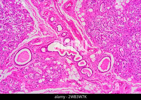 Humane Nabelschnur-Schleimhäute mit Schleimdrüsen, lockeres konjektives Gewebe, Adipozyten, glatten Muskelfasern und Blutgefäßen. X125 bei 10 cm Breite. Stockfoto