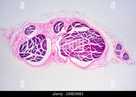 Menschliche Nervenfasern mit Epineurium und Perineurium. X25 bei 10 cm Breite. Stockfoto