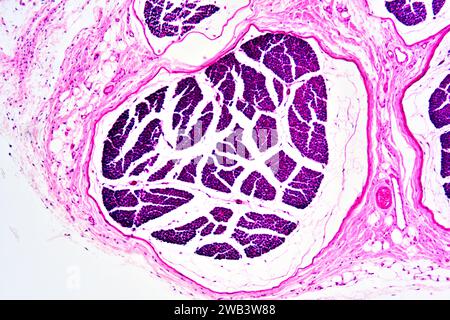 Menschliche Nervenfasern mit Epineurium und Perineurium. X 75 bei 10 cm Breite. Stockfoto