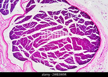 Menschliche Nervenfasern mit Perineurium. X 75 bei 10 cm Breite. Stockfoto