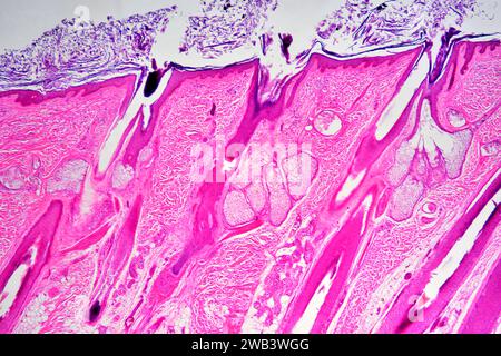 Talgdrüsen in der menschlichen Haut mit Haarfollikeln. X25 bei 10 cm Breite. Stockfoto