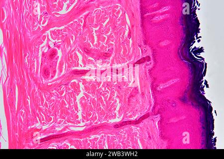 Menschliche Haut mit Epidermis und Dermis mit Schweißdrüsen und Bindegewebe. X 75 bei 10 cm Breite. Stockfoto