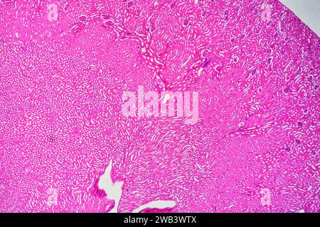 Humaner Nierenabschnitt mit Nierenkortex mit Glomeruli, Malpighian-Teilchen und Nephronen und Nierenmedulla (links und unten). X25 bei 10 cm Breite. Stockfoto