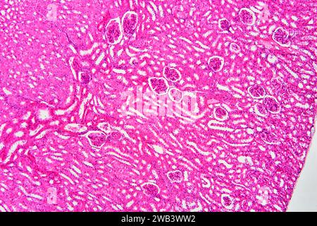 Humaner Nierenabschnitt mit Nierenkortex mit Glomeruli, Malpighian-Teilchen und Nephronen und Nierenmedulla (links). X 75 bei 10 cm Breite. Stockfoto