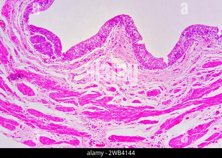 Humaner Harnleiterschnitt zeigt von oben nach unten: Übergangsepithel oder Urothel, glatte Muskelfasern und Bindegewebe. X 75 bei 10 cm Breite. Stockfoto