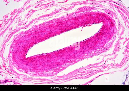 Humanes Arteriol von innen nach außen: Endothel, glatte Schleimfasern und Tunika. X 75 bei 10 cm Breite. Stockfoto