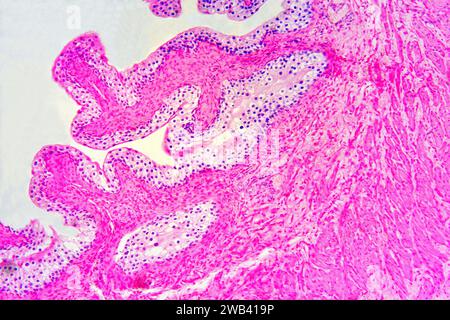 Harnblase mit Urothel (Übergangsepithel), Bindegewebe und glatten Muskelfasern. Photomikrograph X75 mit einer Breite von 10 cm. Stockfoto