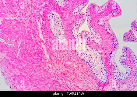 Harnblase mit Urothel (Übergangsepithel), Bindegewebe und glatten Muskelfasern. Photomikrograph X75 mit einer Breite von 10 cm. Stockfoto