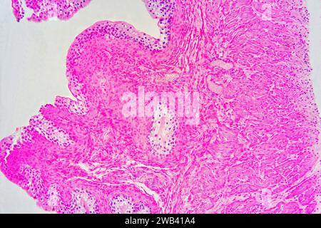 Harnblase mit Urothel (Übergangsepithel), Bindegewebe und glatten Muskelfasern. Photomikrograph X75 mit einer Breite von 10 cm. Stockfoto