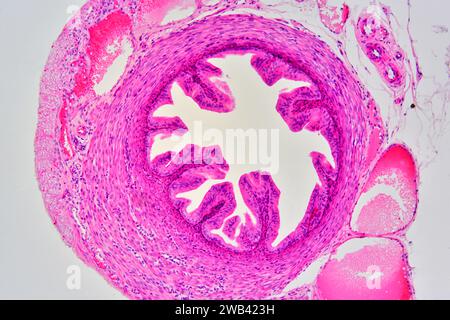 Falopische Röhre, die von außen nach innen zeigt: Serosa, Subserosa, Blutgefäße, Muscularisschicht, Submukosa, Mucosa lamina propria und Flimmerepithel Stockfoto