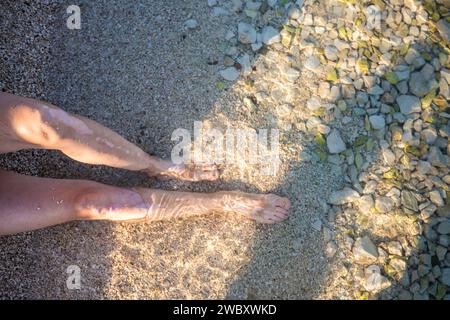 Frauenbeine mit Vitiligo-Pigmentierung Stockfoto