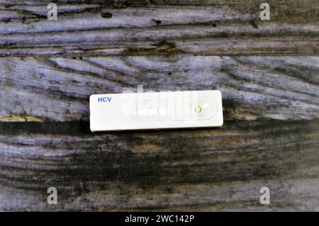 Ein positives Testergebnis des HCV-Blutproben-Schnellscreening-Tests, Hepatitis C ist eine Infektionskrankheit, die durch das Hepatitis-C-Virus verursacht wird, das in erster Linie A Stockfoto