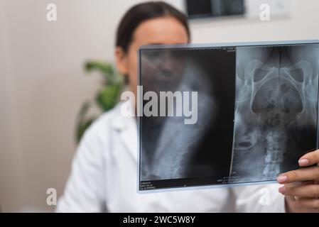Diagnostische Röntgendiagnostik: Ärztliche Krankheitsbeurteilung mit Röntgenfilm Stockfoto