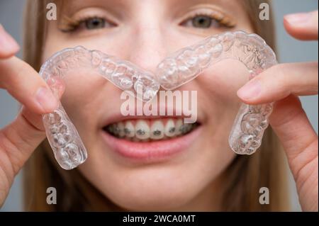 Frau mit Zahnspangen und abnehmbaren transparenten Alignern. Stockfoto